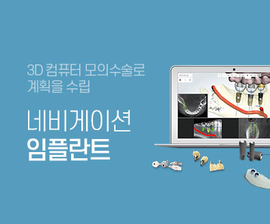 3D �׺���̼� ���ö�Ʈ